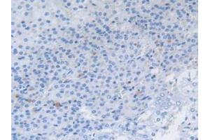 Detection of CCK in Rat Adrenal Gland Tissue using Polyclonal Antibody to Cholecystokinin (CCK)