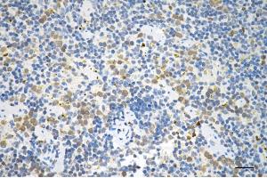 Immunohistochemistry was performed on paraffin-embedded mouse spleen using P70 S6 kinase beta antibody (ABIN7800226), 1:200). (Rekombinanter RPS6KB2 Antikörper)
