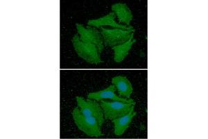 ICC/IF analysis of CALB2 in HeLa cells line, stained with DAPI (Blue) for nucleus staining and monoclonal anti-human CALB2 antibody (1:100) with goat anti-mouse IgG-Alexa fluor 488 conjugate (Green). (Calretinin Antikörper  (AA 1-271))