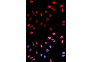 Immunofluorescence analysis of GFP-RNF168 trangenic U2OS cell using RAD18 antibody. (RAD18 Antikörper)