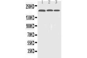 Anti-EGFR Picoband antibody,  All lanes: Anti-EGFR at 0. (EGFR Antikörper  (AA 25-346))