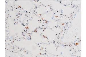 ABIN6267602 at 1/200 staining Rat lung tissue sections by IHC-P. (NF-kB p65 Antikörper  (pSer281))