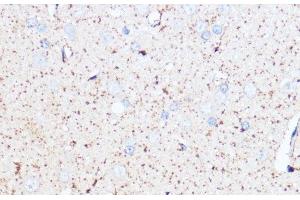 Immunohistochemistry of paraffin-embedded Rat brain using MAOA Polyclonal Antibody at dilution of 1:100 (40x lens). (Monoamine Oxidase A Antikörper)
