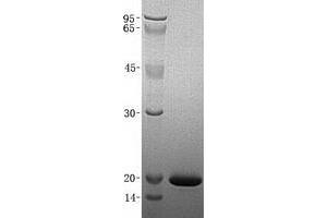 Validation with Western Blot (CST2 Protein (His tag))