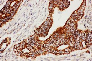 Anti-Secretogranin 3 antibody, IHC(P) IHC(P): Human Rectal Cancer Tissue