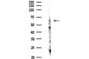 anti-Phosphoribosyl Pyrophosphate Amidotransferase (PPAT) (N-Term) antibody