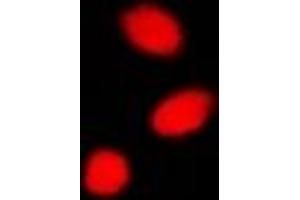 Immunofluorescent analysis of CBX4 staining in A549 cells. (CBX4 Antikörper)