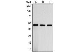 Western blot analysis of ARRDC3 expression in Jurkat (A), mouse liver (B), rat liver (C) whole cell lysates. (ARRDC3 Antikörper  (C-Term))
