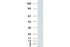Western Blotting (WB) image for Interferon gamma Receptor 1 (IFNGR1) protein (Myc-DYKDDDDK Tag) (ABIN2713385)