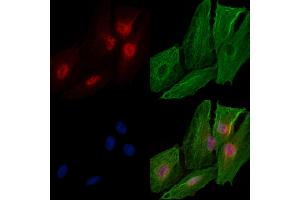 ABIN6259230 and ABIN6274702 staining  cells by IF/ICC. (RAD54L Antikörper  (C-Term))