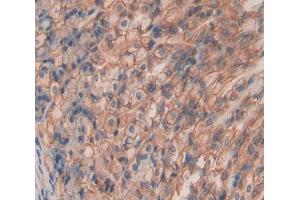 Used in DAB staining on fromalin fixed paraffin- embedded Kidney tissue (SHISA4 Antikörper  (AA 28-197))
