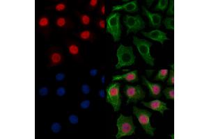 MYEOV Antibody staining HepG2 cells by IF/ICC. (MYEOV Antikörper  (Internal Region))