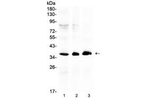 Western blot testing of human 1) HeLa, 2) COLO320 and 3) SW620 cell lysate with AKR1B10 antibody at 0.
