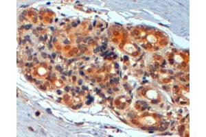WNT3 polyclonal antibody (Cat # PAB7032, 2 ug/mL) staining of paraffin embedded human breast. (WNT3 Antikörper  (Internal Region))