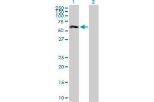 Western Blot analysis of ST8SIA2 expression in transfected 293T cell line by ST8SIA2 MaxPab polyclonal antibody. (ST8SIA2 Antikörper  (AA 1-354))