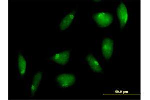 Immunofluorescence of purified MaxPab antibody to TTK on HeLa cell. (Mps1 Antikörper  (AA 1-857))