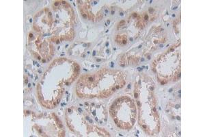 Used in DAB staining on fromalin fixed paraffin- embedded Kidney tissue (GBP4 Antikörper  (AA 1-292))