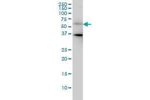CDC25C monoclonal antibody (M01), clone 3B11 Western Blot analysis of CDC25C expression in HeLa .
