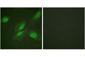 Immunofluorescence (IF) image for anti-V-Akt Murine Thymoma Viral Oncogene Homolog 1 (AKT1) (AA 292-341) antibody (ABIN2888779) (AKT1 Antikörper  (AA 292-341))