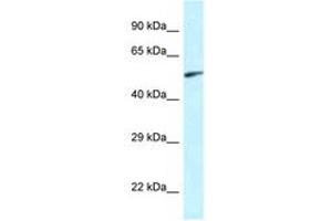 Image no. 1 for anti-Eyes Absent Homolog 2 (Drosophila) (EYA2) (AA 200-249) antibody (ABIN6747418) (EYA2 Antikörper  (AA 200-249))