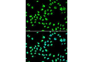 Immunofluorescence analysis of A549 cells using GTF2F2 antibody. (GTF2F2 Antikörper)