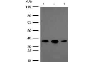 All lanes : OXGR1 Rabbit mAb at 1/1k dilution Lane 1 : Hela whole cell lysates Lane 2 : A549 whole cell lysates Lane 3 : HUVEC whole cell lysates Lysates/proteins at 20 μg per lane. (Rekombinanter OXGR1 Antikörper)