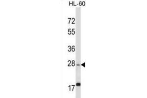 Western Blotting (WB) image for anti-Apolipoprotein O-Like (APOOL) antibody (ABIN2997795) (APOOL Antikörper)