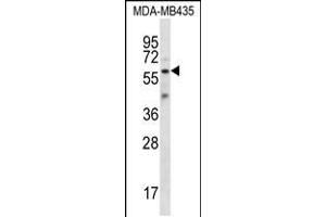Western blot analysis in MDA-MB435 cell line lysates (35ug/lane). (Fascin 3 Antikörper  (C-Term))