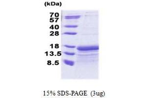SDS-PAGE (SDS) image for TAF10 RNA Polymerase II, TATA Box Binding Protein (TBP)-Associated Factor, 30kDa (TAF10) (AA 84-218) protein (His tag) (ABIN5853264)