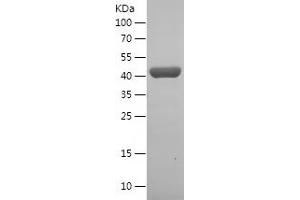 Western Blotting (WB) image for Glutamic-Oxaloacetic Transaminase 1, Soluble (Aspartate Aminotransferase 1) (GOT1) (AA 2-413) protein (His tag) (ABIN7123115) (GOT1 Protein (AA 2-413) (His tag))