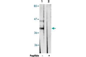 Western blot analysis of extracts from mouse brain cells, using PRKACA polyclonal antibody .