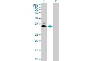 Western Blot analysis of KIAA0247 expression in transfected 293T cell line by KIAA0247 MaxPab polyclonal antibody. (SUSD6/KIAA0247 Antikörper  (AA 1-303))