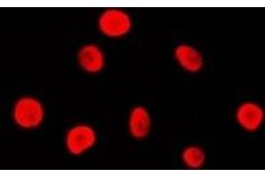 Immunofluorescent analysis of MSH2 staining in Hela cells. (MSH2 Antikörper)