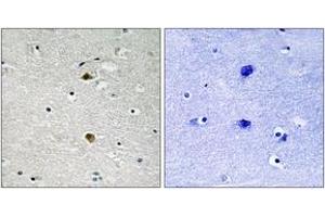 Immunohistochemistry analysis of paraffin-embedded human brain tissue, using NF-kappaB p65 (Ab-281) Antibody. (NF-kB p65 Antikörper  (AA 247-296))