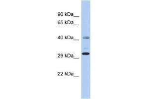 WB Suggested Anti-C11orf46 Antibody Titration: 0.