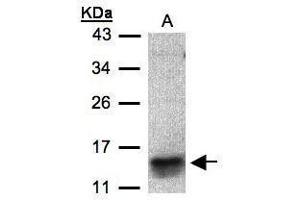 WB Image Sample(30 μg of whole cell lysate) A:MOLT4, 15% SDS PAGE antibody diluted at 1:500 (CCL1 Antikörper  (C-Term))