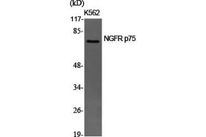 Western Blotting (WB) image for anti-Nerve Growth Factor Receptor (NGFR) (Internal Region) antibody (ABIN5956122) (NGFR Antikörper  (Internal Region))