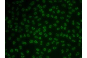 Immunofluorescence analysis of MCF7 cells using KHDRBS3 antibody (ABIN6131841, ABIN6142833, ABIN6142834 and ABIN6222332). (KHDRBS3 Antikörper  (AA 177-346))