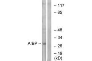 Western blot analysis of extracts from HeLa cells, using AIBP Antibody. (C1orf135 Antikörper  (AA 121-170))