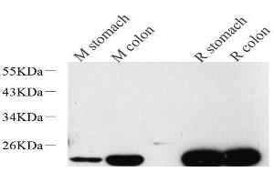 Western Blot analysis of various samples using TAGLN Polyclonal Antibody at dilution of 1:600. (Transgelin Antikörper)