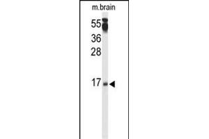 Western blot analysis of P3R2 Antibody (N-term) (ABIN653332 and ABIN2842820) in mouse brain tissue lysates (35 μg/lane). (Calcineurin B Antikörper  (N-Term))