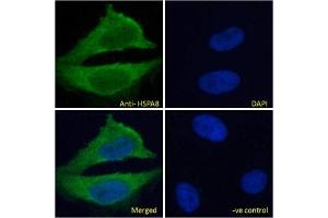 IF/ICC testing of fixed and permeabilized human HeLa cells with HSPA8 antibody (green) at 10ug/ml and DAPI nuclear stain (blue). (Hsc70 Antikörper)