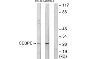 Western blot analysis of extracts from LOVO/RAW264. (CEBPD, CEBPE Antikörper  (AA 171-220))