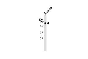 Western blot analysis of lysate from rat uterus tissue lysate, using BR1A Antibody (E45) (ABIN388732 and ABIN2838941). (BMPR1A Antikörper  (N-Term))