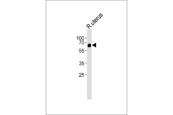 BMPR1A Antikörper  (N-Term)