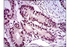 Immunohistochemistry (IHC) image for anti-E2F Transcription Factor 1 (E2F1) (AA 69-223) antibody (ABIN1845545) (E2F1 Antikörper  (AA 69-223))