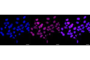 anti-Methyl-CpG Binding Domain Protein 3 (MBD3) antibody