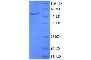 SDS-PAGE (SDS) image for Anaphase Promoting Complex Subunit 5 (ANAPC5) (AA 2-232), (partial) protein (GST tag) (ABIN1046518) (ANAPC5 Protein (AA 2-232, partial) (GST tag))