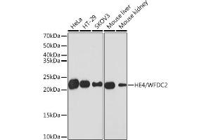 Western blot analysis of extracts of various cell lines, using HE4/WFDC2 Rabbit mAb (ABIN1682653, ABIN3017632, ABIN3017633 and ABIN7101513) at 1:1000 dilution. (WFDC2 Antikörper)