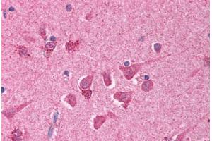 Human Brain, Cortex (formalin-fixed, paraffin-embedded) stained with BCL10 antibody ABIN214608 at 10 ug/ml followed by biotinylated goat anti-rabbit IgG secondary antibody ABIN481713, alkaline phosphatase-streptavidin and chromogen. (BCL10 Antikörper  (AA 5-19))